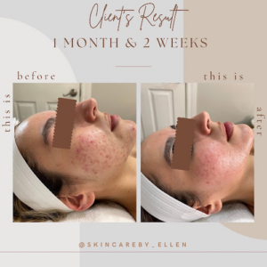 Skincare by Ellen